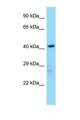 LDB2 Antibody (N-Terminus)