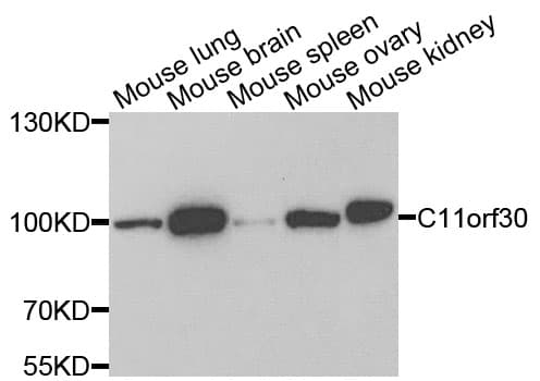 C11orf30 / EMSY Antibody