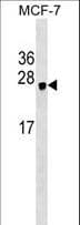 Polyclonal Rabbit anti-Human HEBP1 Antibody (aa5-32, WB)