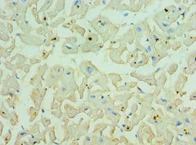 CDH13 / Cadherin 13 Antibody (aa120-370)