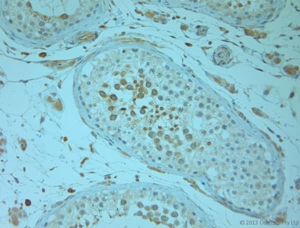 Polyclonal Rabbit anti-Human REEP5 Antibody (aa150-189, IHC)