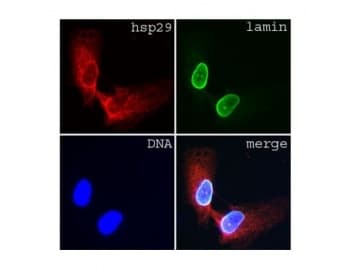 Monoclonal Mouse anti-Human LMNA / Lamin A+C Antibody (clone JoL3, IF, WB)