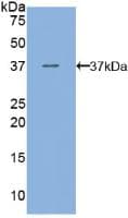 FLT4 / VEGFR3 Antibody (aa30-326)