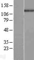 ABL1 / c-ABL Protein (Over-Expression Lysate Myc-DDK (Flag))