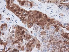 Monoclonal Mouse anti-Human 15-PGDH / HPGD Antibody (clone OTI2F5, IHC, WB)