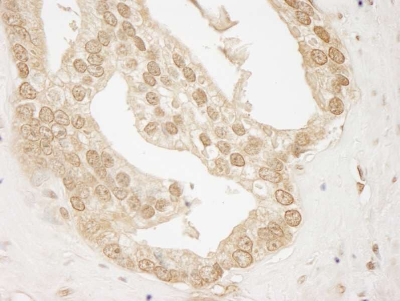 AKT1 Antibody (aa25-75)