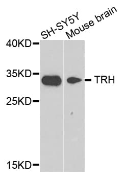 Polyclonal Rabbit anti-Human TRH / Thyrotropin Releasing Hormone Antibody (IHC, WB)