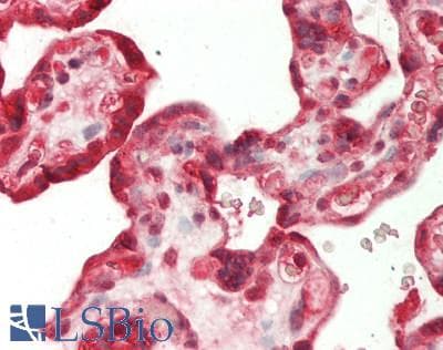 IHC-plus™ Polyclonal Rabbit anti-Human LNPEP Antibody (aa1-50, IHC, WB)