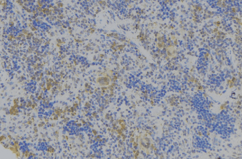 Polyclonal Rabbit anti-Human GPA33 / A33 Antibody (IHC, WB)