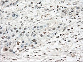 TYRO3 Antibody (clone OTI9B12)