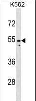 PAX2 Antibody (aa187-216)