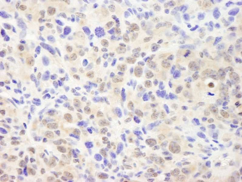 Polyclonal Rabbit anti-Human COPS2 / TRIP15 / ALIEN Antibody (aa1-50, IHC)