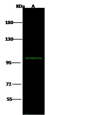 AP1B1 / BAM22 Antibody (Preservative Free)