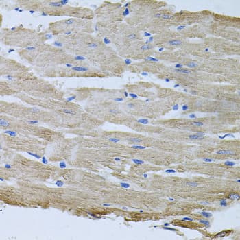 TARS Antibody