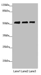 Polyclonal Rabbit anti-Human PRPF4 Antibody (IHC, WB)