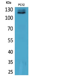 UBA1 / UBE1 Antibody