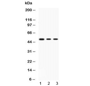 Polyclonal Rabbit anti-Human PRKAR1A Antibody (IHC, WB)