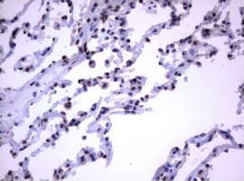 RASGRP3 / GRP3 Antibody (clone OTI2G7)