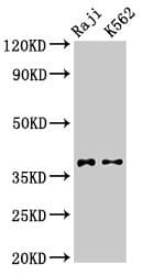 Polyclonal Rabbit anti-Human DMC1 Antibody (IHC, IF, WB)