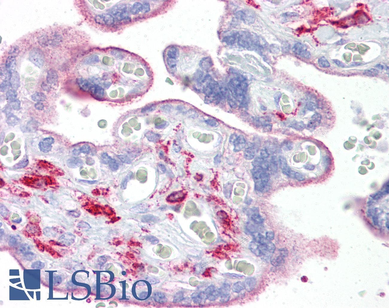 IHC-plus™ OGFOD1 Antibody