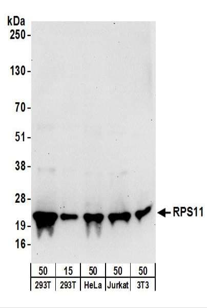 RPS11 / Ribosomal Protein 11 Antibody (aa108-158)
