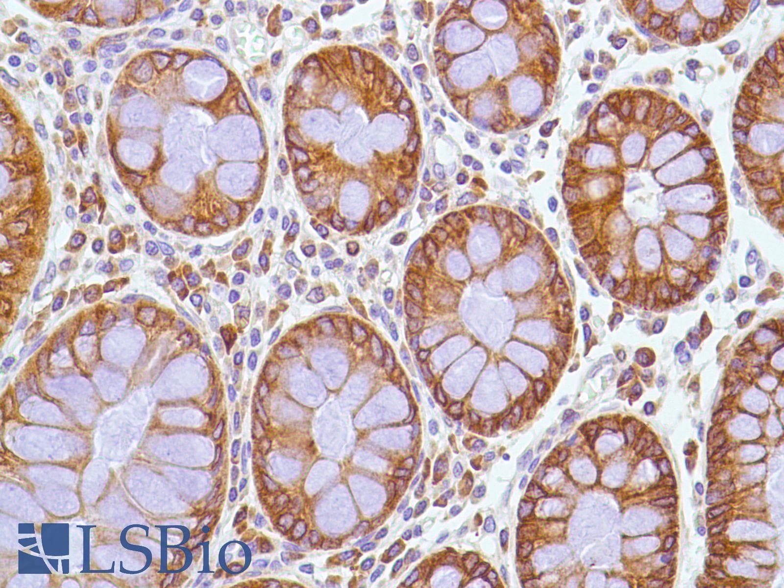 PTGS2 / COX2 / COX-2 Antibody (C-Terminus, clone SP21)