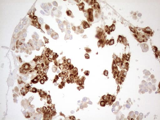 Monoclonal Mouse anti-Human GRN / Granulin Antibody (clone OTI3H6, aa327-593, IHC, WB)