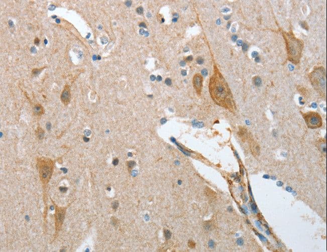 NOL3 / ARC Antibody