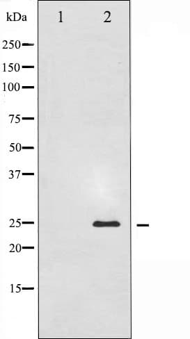 TK1 / TK / Thymidine Kinase Antibody