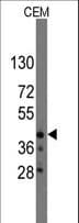 IHC-plus™ Polyclonal Rabbit anti-Human QKI Antibody (aa1-30, IHC, WB)