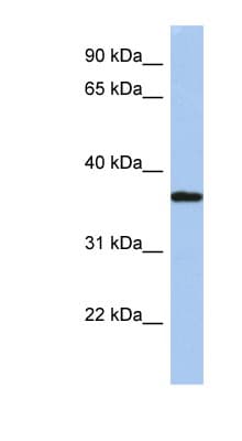 ARH / LDLRAP1 Antibody (aa35-84)