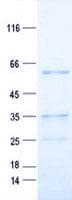 Human PPARA / PPAR Alpha Protein (Recombinant His, N-Terminal)