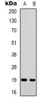 Polyclonal Rabbit anti-Human STMN1 / Stathmin / LAG Antibody (N-Terminus, IHC, IF, WB)