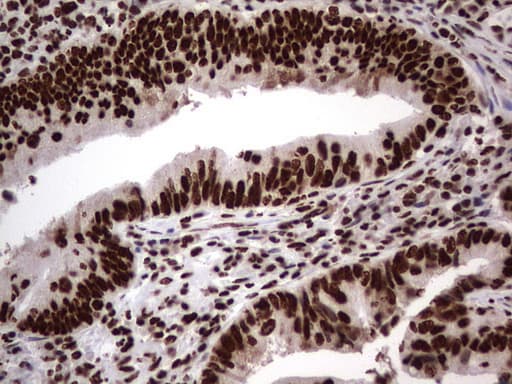 HNRNPL / hnRNP L Antibody (aa270-502, clone OTI9F11)