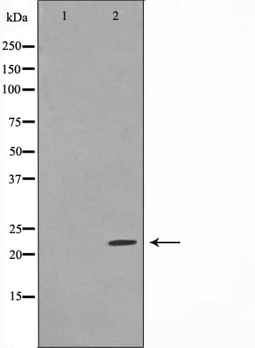 BAD Antibody