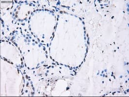 Monoclonal Mouse anti-Human ID3 Antibody (clone OTI8B3, IHC, IF, WB)