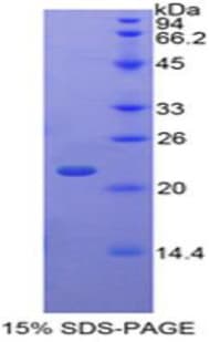 Human TAF12 Protein (Recombinant His-T7)