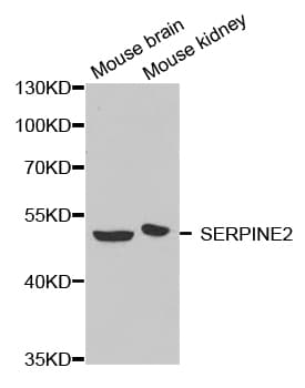 SERPINE2 / Nexin Antibody