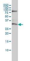 IHC-plus™ STK16 Antibody (clone M2)