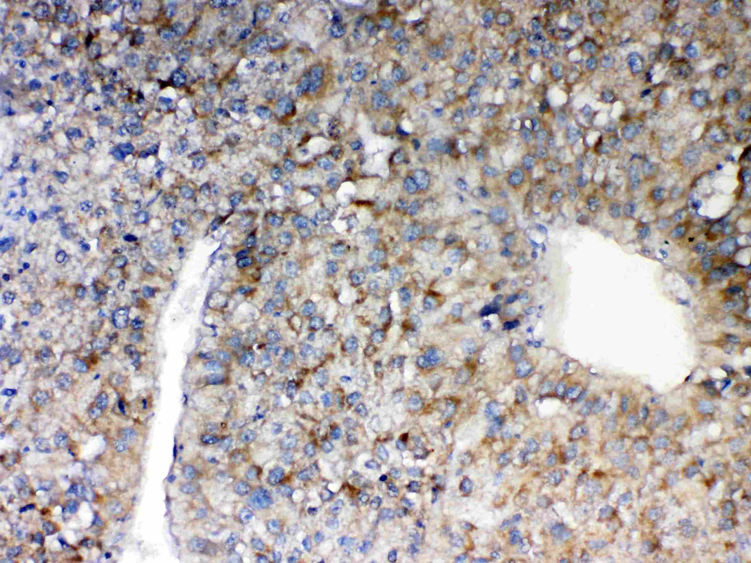 VISA / MAVS Antibody