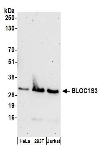 BLOC1S3 Antibody (aa1-50)