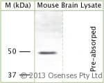 Polyclonal Rabbit anti-Rat KCNJ12 / Kir2.2 Antibody (Cytoplasmic Domain, WB)