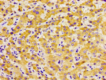 SOX11 Antibody