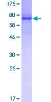 Human PIP4K2A / PIPK Protein (Recombinant GST)