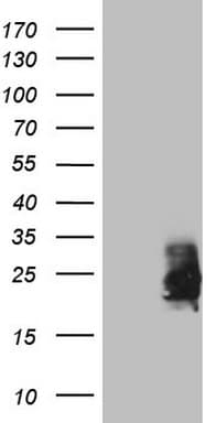 CSF2 / GM-CSF Antibody (aa18-144, clone OTI13E6)