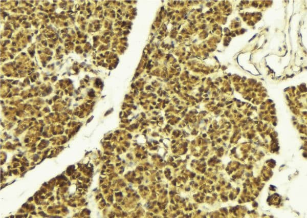PTEN Antibody