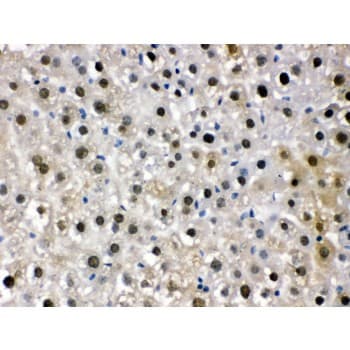 DDB1 Antibody (aa1011-1140)
