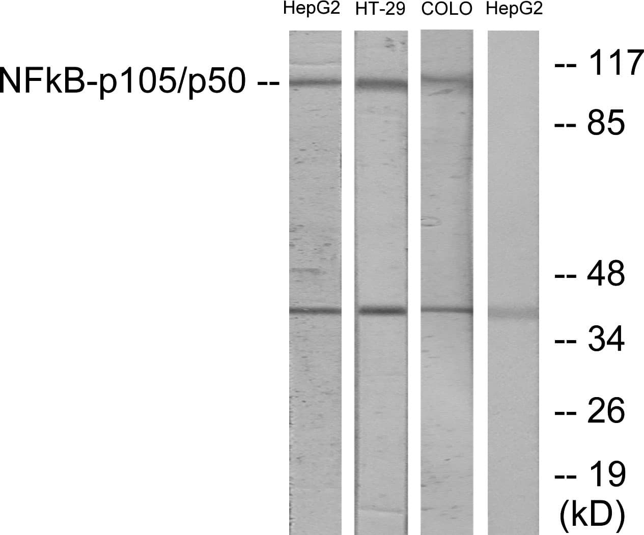 Polyclonal Rabbit anti-Human NFKB1 / NF-Kappa-B Antibody (aa874-923, IHC, WB)