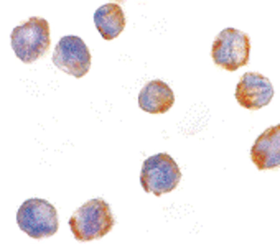 IHC-plus™ MTBP / Mdm2-Binding Protein Antibody