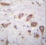 Polyclonal Rabbit anti-Human PLCL2 Antibody (aa1099-1126, IHC, IF, WB)